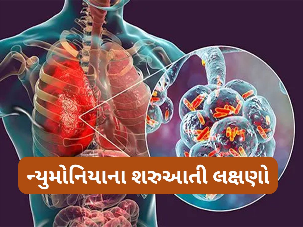 Pneumonia: જીવલેણ ન્યુમોનિયાના શરુઆતી લક્ષણો, ઉધરસને સામાન્ય ગણી લાંબા સમય સુધી ઈગ્નોર ન કરો Pneumonia: જીવલેણ ન્યુમોનિયાના શરુઆતી લક્ષણો, ઉધરસને સામાન્ય ગણી લાંબા સમય સુધી ઈગ્નોર ન કરો