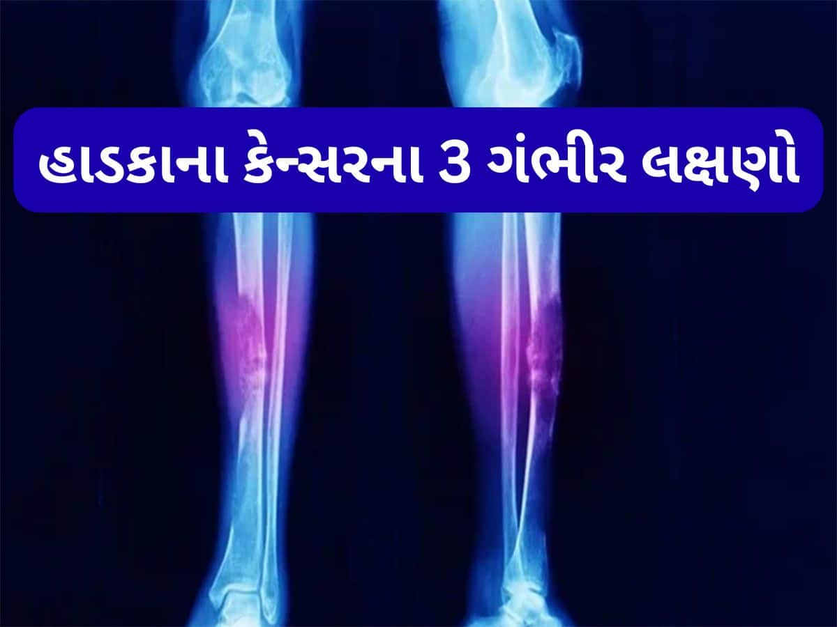 Bone Cancer: હાડકાનું કેન્સર ગંભીર સ્ટેજમાં પહોંચે ત્યારે દેખાય છે આ લક્ષણ, શરીરના આ ભાગમાં થાય અસહ્ય દુખાવો