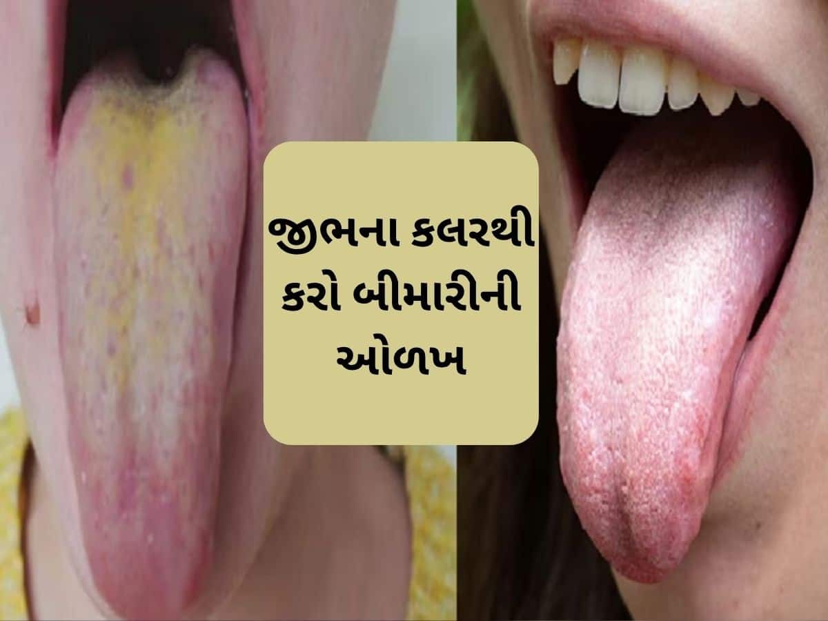  જીભ પર લાલ, પીળા, વાદળી રંગના નિશાન દેખાય તો સાવધાન રહો, આ રોગોનું લક્ષણ હોઈ શકે છે