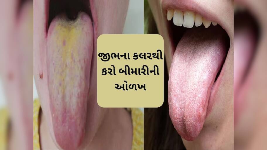  જીભ પર લાલ, પીળા, વાદળી રંગના નિશાન દેખાય તો સાવધાન રહો, આ રોગોનું લક્ષણ હોઈ શકે છે