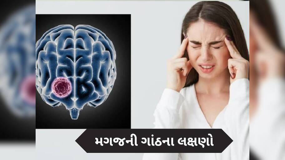  બ્રેન ટ્યુમર થાય તો જોવા મળે છે આ 5 લક્ષણ, સામાન્ય સમજી નજરઅંદાજ કરશો તો પડશે ભારે