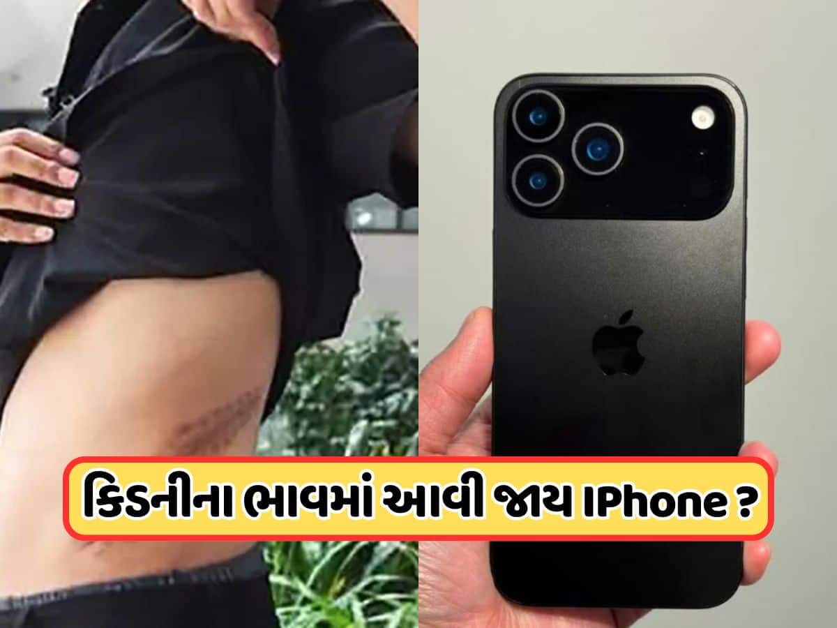 શું કોઈ વ્યક્તિ કિડની વેચીને આઈફોન ખરીદી શકે છે? કિડનીની કિંમત કેટલી છે?