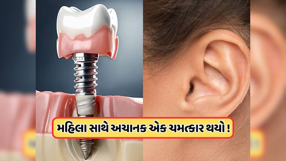 સુરતમાં થયો ચમત્કાર ! દાંતની સર્જરીએ સાજા કરી દીધા મહિલાના કાન, 10 વર્ષથી મહિલાને હતી તકલીફ