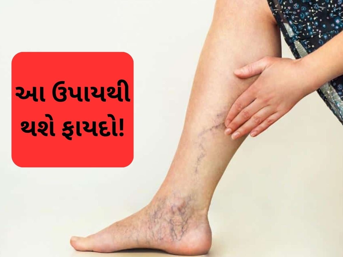 બંધ અને જામ થયેલી નસો ખોલવા માટે સ્વામી રામદેવના આ ઉપાયો અપનાવો, દુખાવામાં રાહત મળશે બંધ અને જામ થયેલી નસો ખોલવા માટે સ્વામી રામદેવના આ ઉપાયો અપનાવો, દુખાવામાં રાહત મળશે
