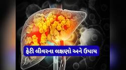 લીવરને સડતા બચાવવું હોય તો આ રીતે ખાવી હળદર, આ ઉપાય ફેટી લીવરમાં કરશે ફાયદો