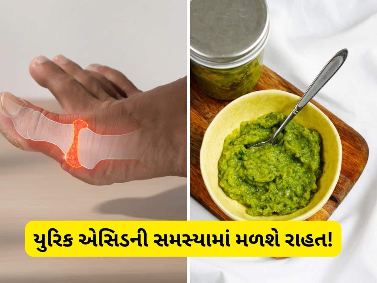   શરીરમાં વધી ગયેલા યુરિક એસિડને શોષી લેશે આ ચટણી, કિડનીની તાકાત વધી જશે, આ રીતે ઘરે તૈયાર કરો