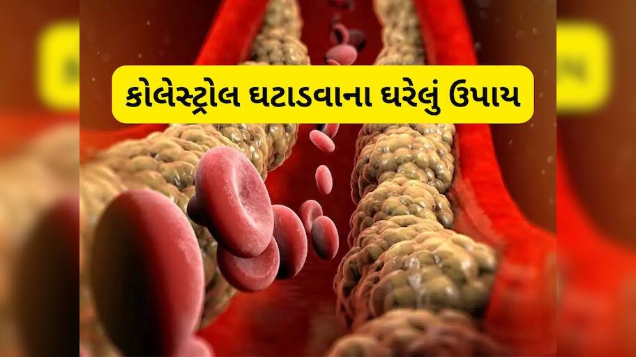 આ પાણી ખાલી પેટ પીઓ, તમારી નસોમાં જામેલા બેડ કોલેસ્ટ્રોલને કરશે દૂર!