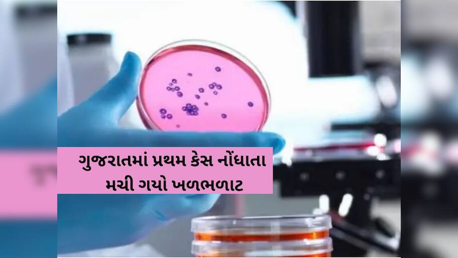 દુનિયામાં ભાગ્યે જ જોવા મળતો રેર ઓફ ધ રેર રોગ ગુજરાતમાં નોંધાયો! જાણો આ બિમારીનો છે કોઈ ઈલાજ