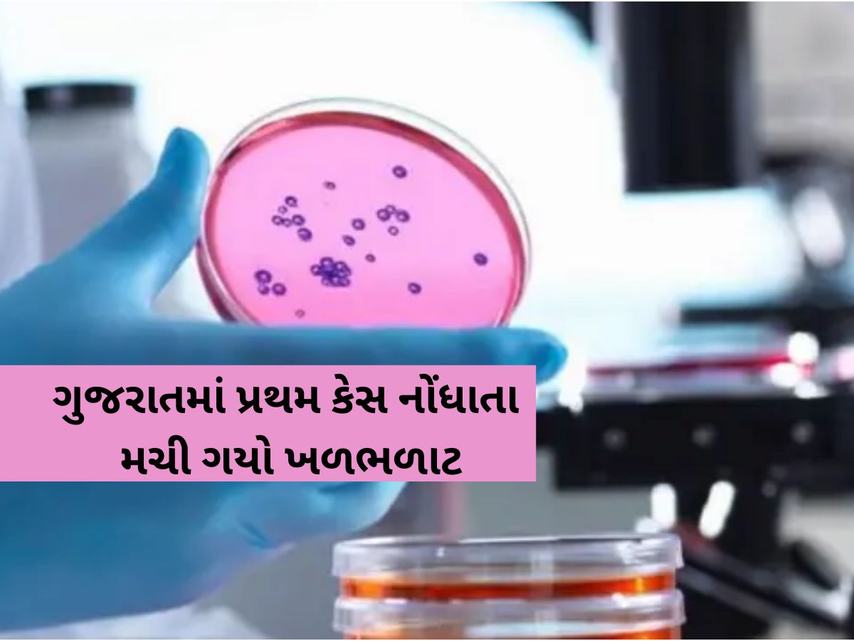 દુનિયામાં ભાગ્યે જ જોવા મળતો રેર ઓફ ધ રેર રોગ ગુજરાતમાં નોંધાયો! જાણો આ બિમારીનો છે કોઈ ઈલાજ દુનિયામાં ભાગ્યે જ જોવા મળતો રેર ઓફ ધ રેર રોગ ગુજરાતમાં નોંધાયો! જાણો આ બિમારીનો છે કોઈ ઈલાજ