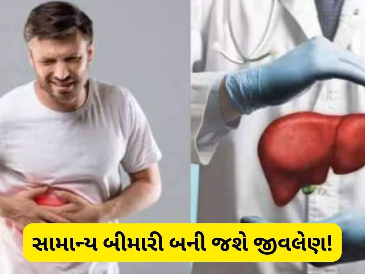 લિવરને ચૂપચાપ ખતમ કરી નાખે છે આ બીમારી, 99 ટકા લોકો નથી આપતા ધ્યાન