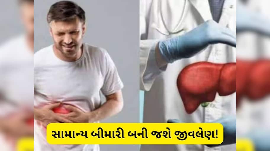 લિવરને ચૂપચાપ ખતમ કરી નાખે છે આ બીમારી, 99 ટકા લોકો નથી આપતા ધ્યાન