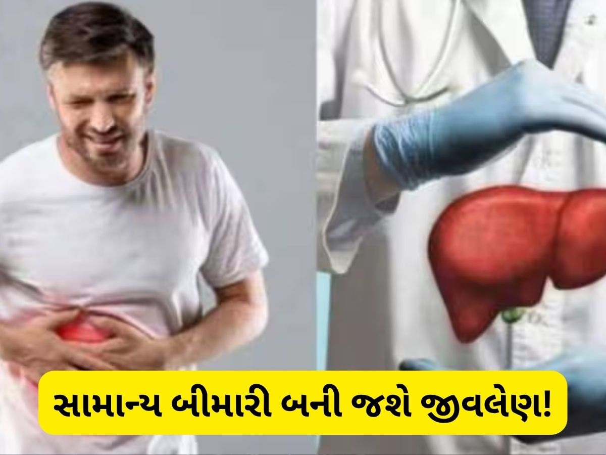 લિવરને ચૂપચાપ ખતમ કરી નાખે છે આ બીમારી, 99 ટકા લોકો નથી આપતા ધ્યાન લિવરને ચૂપચાપ ખતમ કરી નાખે છે આ બીમારી, 99 ટકા લોકો નથી આપતા ધ્યાન