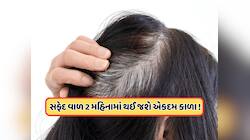 આયુર્વેદિક રીતે સફેદ વાળથી મેળવો છુટકારો, ડોક્ટરે જણાવ્યા ઘરેલું ઉપાય !