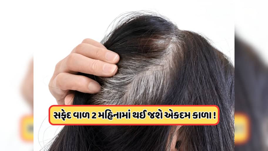 આયુર્વેદિક રીતે સફેદ વાળથી મેળવો છુટકારો, ડોક્ટરે જણાવ્યા ઘરેલું ઉપાય !