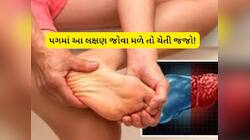 તમારા પગમાં જોવા મળશે ખરાબ લીવરના આ લક્ષણ, નજરઅંદાજ કરશો તો પડશે ભારે!