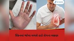 તમારી સ્કિન જણાવશે તમારા હાર્ટના સ્વાસ્થ્યનો હાલ, 6 ઈશારા મળે તો ડોક્ટર પાસે ભાગો