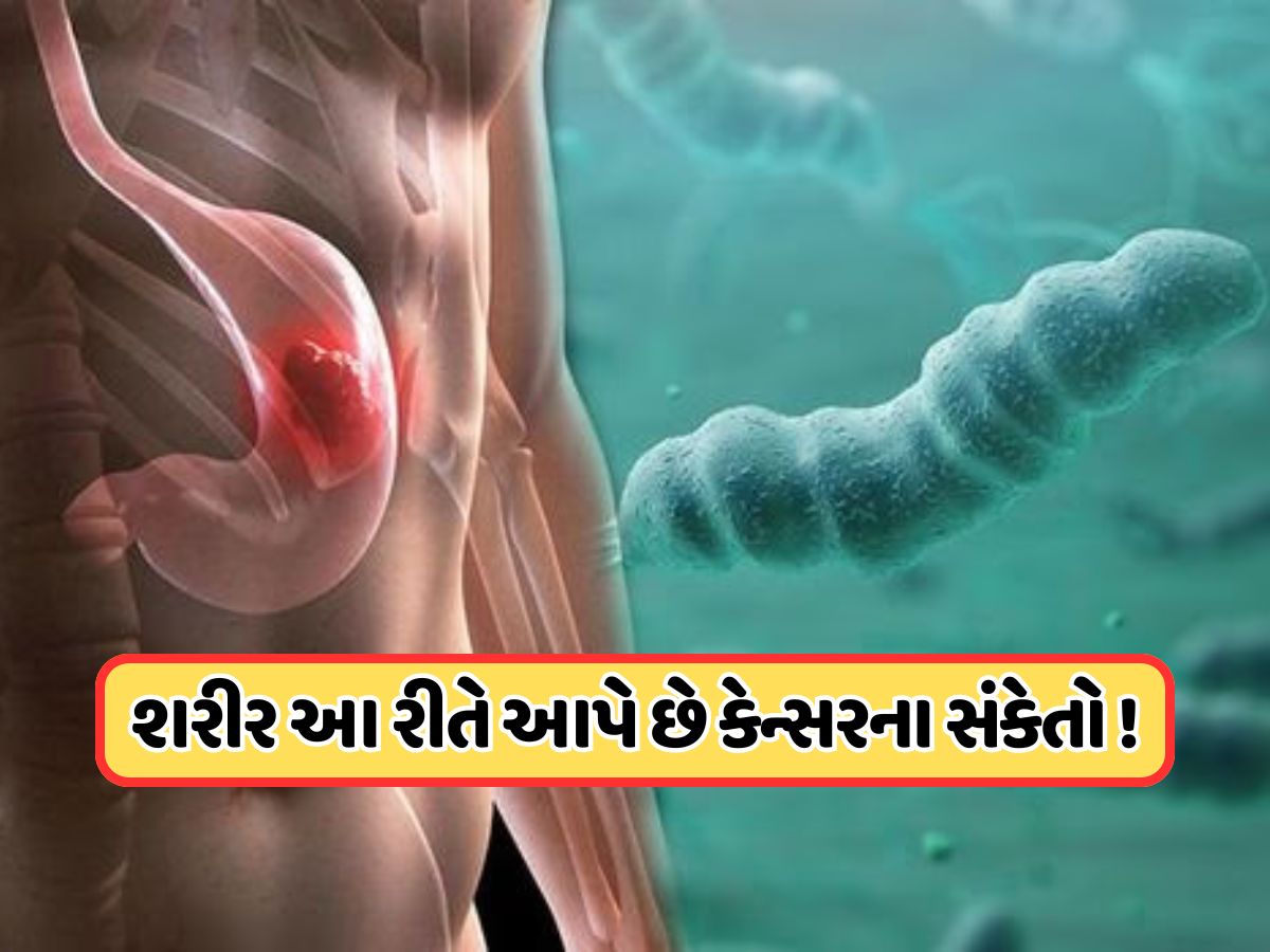 શરીર શરૂઆતમાં જ આપી દે છે પેટના કેન્સરના 5 સંકેતો, ચોથું લક્ષણ શંકાને વધુ ઘેરી બનાવશે શરીર શરૂઆતમાં જ આપી દે છે પેટના કેન્સરના 5 સંકેતો, ચોથું લક્ષણ શંકાને વધુ ઘેરી બનાવશે