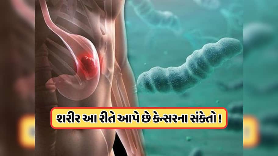 શરીર શરૂઆતમાં જ આપી દે છે પેટના કેન્સરના 5 સંકેતો, ચોથું લક્ષણ શંકાને વધુ ઘેરી બનાવશે