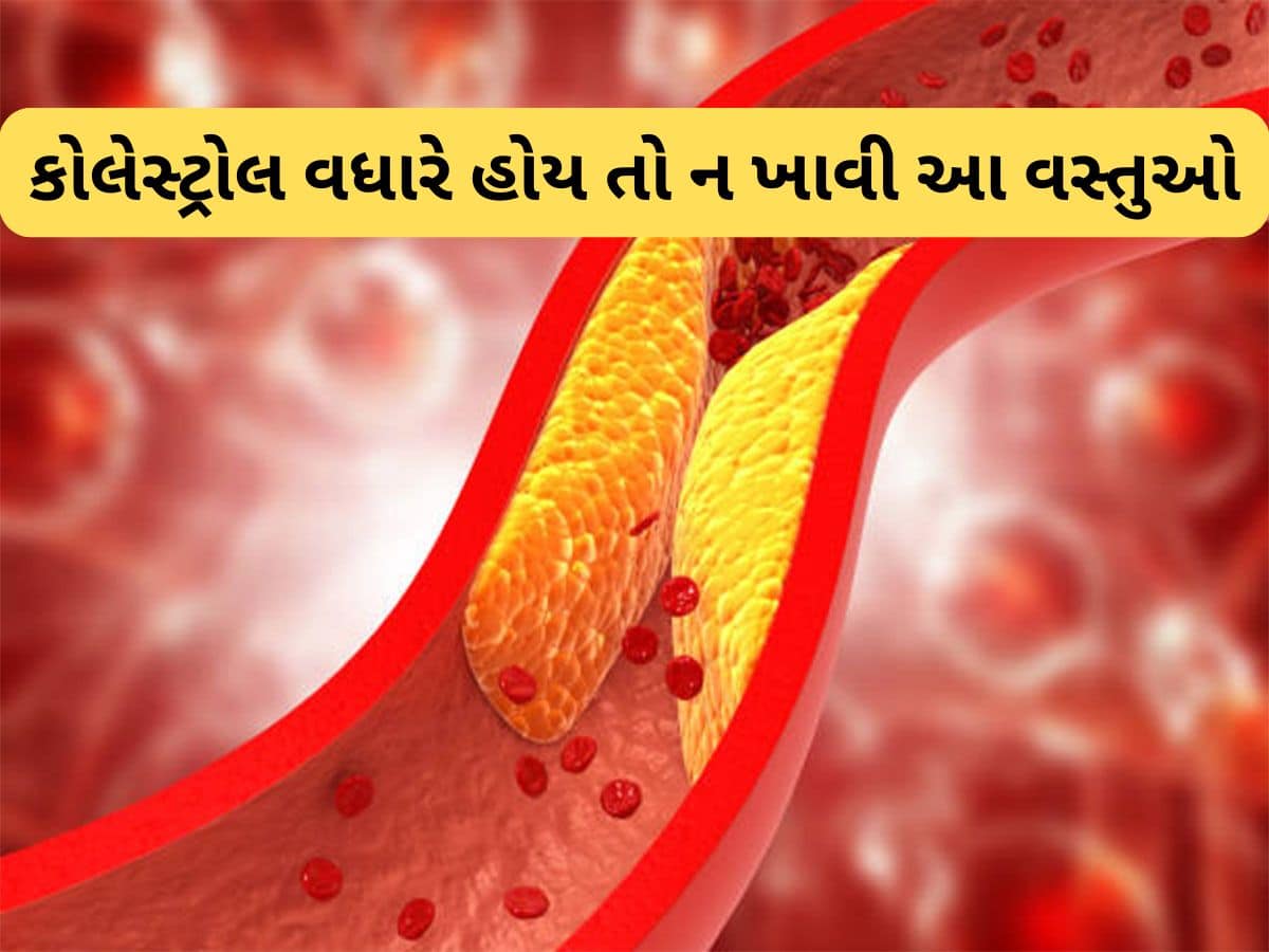 High Cholesterol: કોલેસ્ટ્રોલ હાઈ રહેતું હોય તો ન ખાતા આ Foods, ખાવાથી બ્લોક થઈ જશે ધમનીઓ