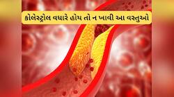 કોલેસ્ટ્રોલ હાઈ રહેતું હોય તો ન ખાતા આ Food, ખાવાથી બ્લોક થઈ જશે ધમનીઓ