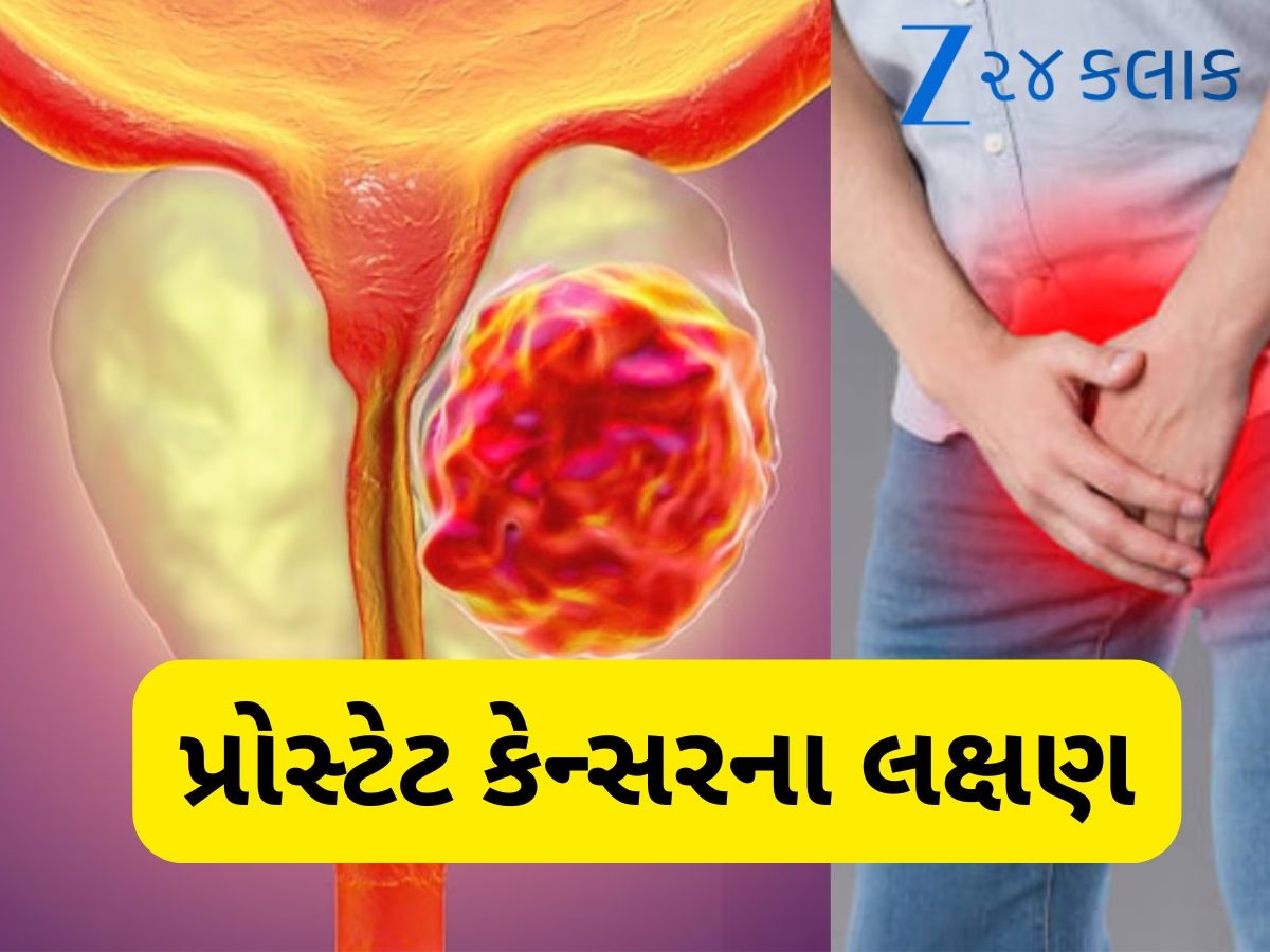 શરીરમાં આ લક્ષણ જોવા મળે તો સમજી લો થઈ ગયું પ્રોસ્ટેટ કેન્સર, સીધા ડોક્ટર પાસે પહોંચો શરીરમાં આ લક્ષણ જોવા મળે તો સમજી લો થઈ ગયું પ્રોસ્ટેટ કેન્સર, સીધા ડોક્ટર પાસે પહોંચો