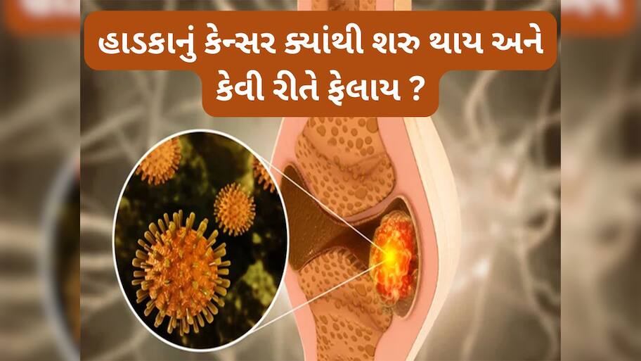 Bone Cancer: શરીરમાં ક્યાંથી શરુ થાય હાડકાનું કેન્સર ? જાણો હાડકાના કેન્સરથી બચવા શું કરવું જોઈએ