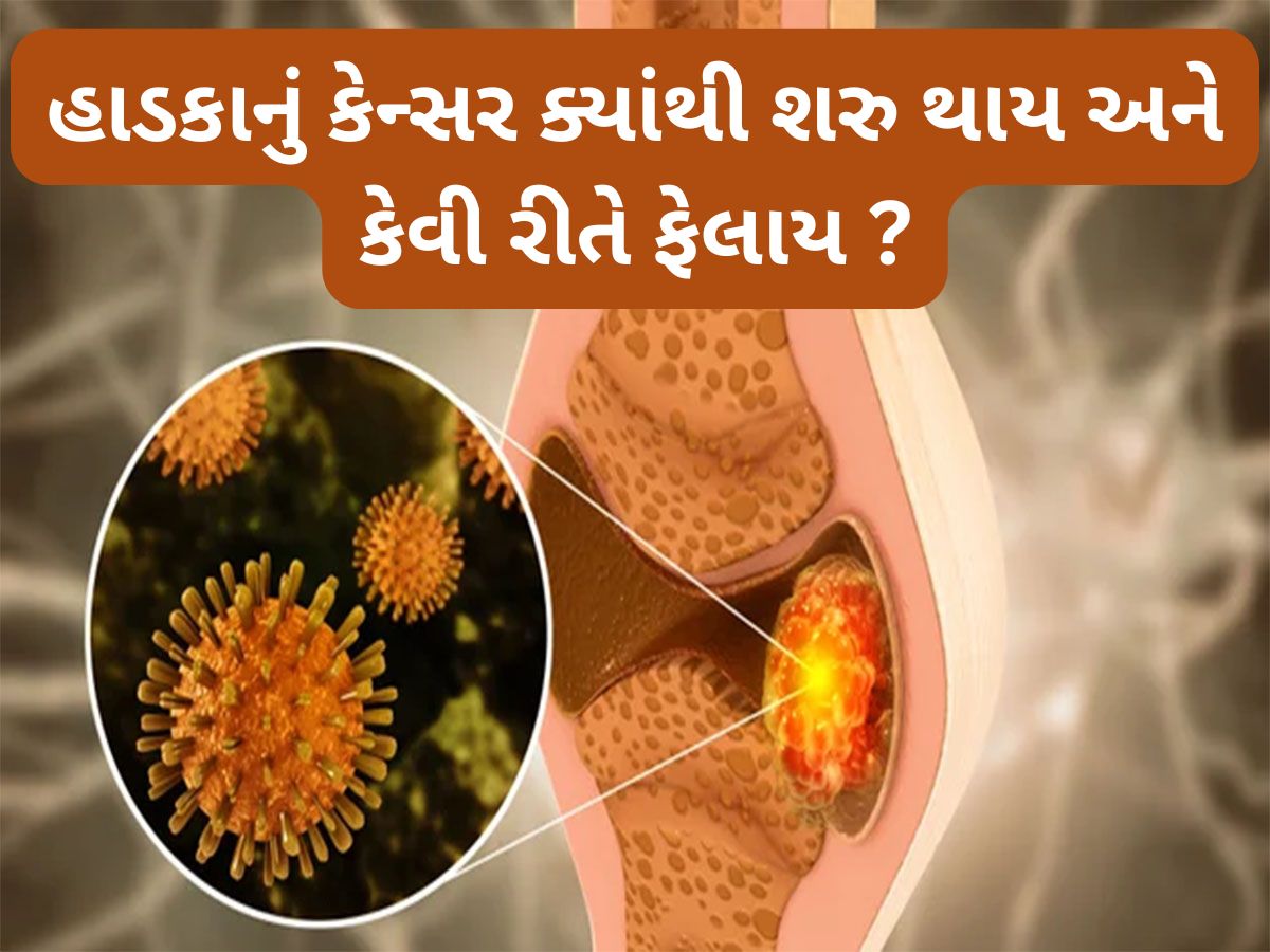 Bone Cancer: શરીરમાં ક્યાંથી શરુ થાય હાડકાનું કેન્સર ? જાણો હાડકાના કેન્સરથી બચવા શું કરવું જોઈએ Bone Cancer: શરીરમાં ક્યાંથી શરુ થાય હાડકાનું કેન્સર ? જાણો હાડકાના કેન્સરથી બચવા શું કરવું જોઈએ