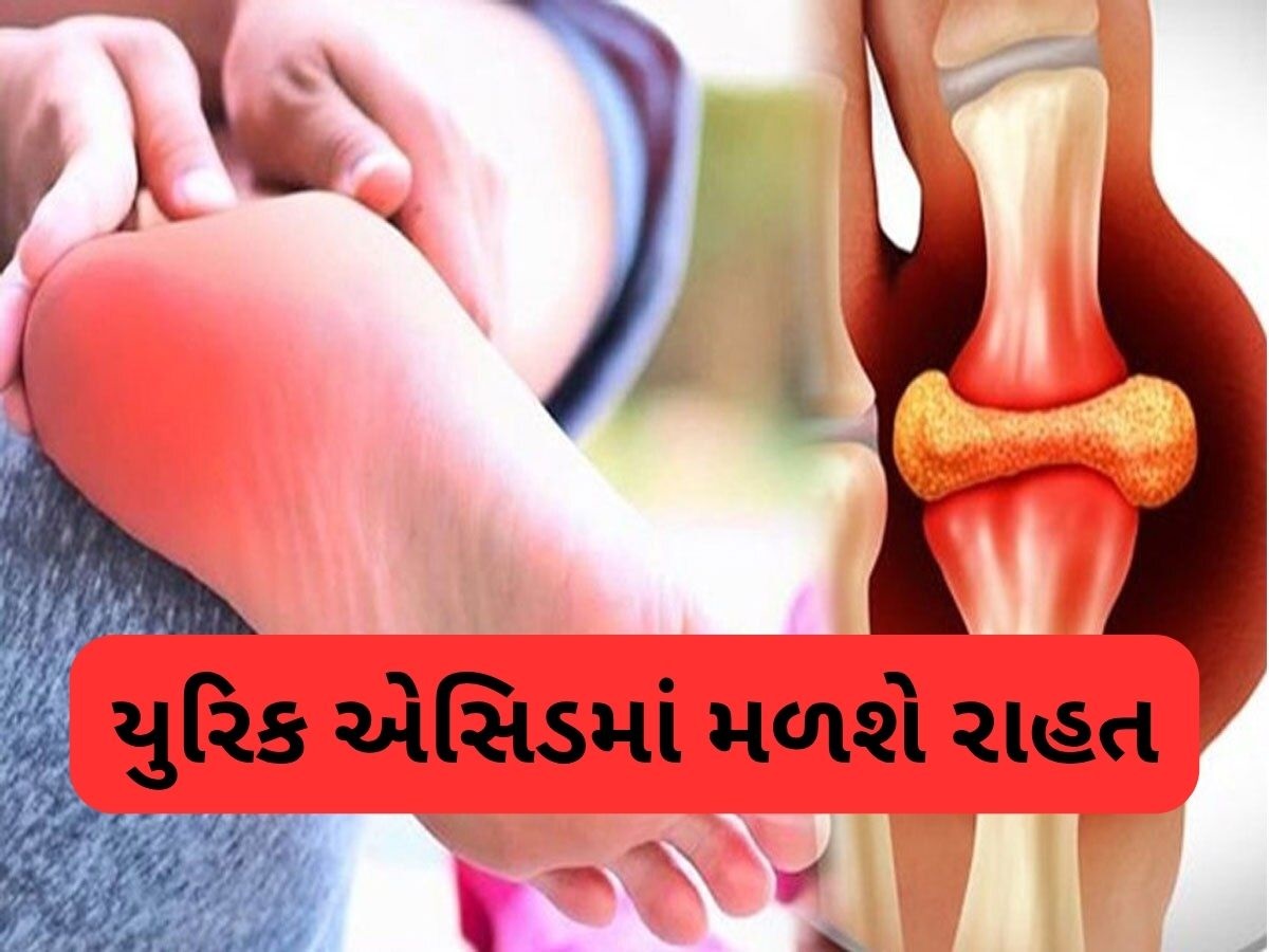 ઝડપથી કંટ્રોલ થશે હાઈ યુરિક એસિડ, બસ તમારા ડાયટમાં સામેલ કરો આ 5 વસ્તુ! ઝડપથી કંટ્રોલ થશે હાઈ યુરિક એસિડ, બસ તમારા ડાયટમાં સામેલ કરો આ 5 વસ્તુ!