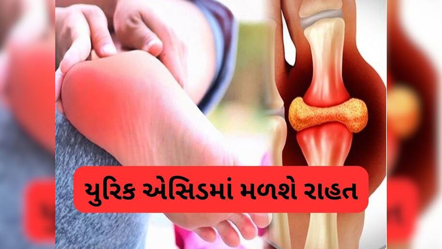 ઝડપથી કંટ્રોલ થશે હાઈ યુરિક એસિડ, બસ તમારા ડાયટમાં સામેલ કરો આ 5 વસ્તુ!