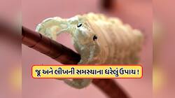 વરસાદની ઋતુમાં વધી ગઈ છે જૂ અને લીખની સમસ્યા ? આ ઘરેલું ઉપાયોથી મેળવો છુટકારો !