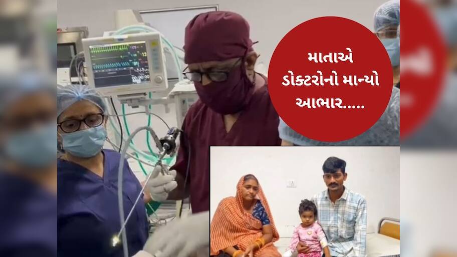 2 વર્ષની બાળકીની શ્વાસનળીમાં ફસાયો મગફળીનો દાણો, સિવિલના ડોક્ટરોએ બચાવ્યો જીવ