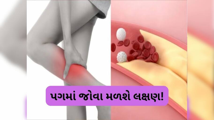 તમારા પગ જ આપશે હાઈકોલેસ્ટ્રોલના સંકેતો, નજરઅંદાજ કરશો તો ભારે પડશે