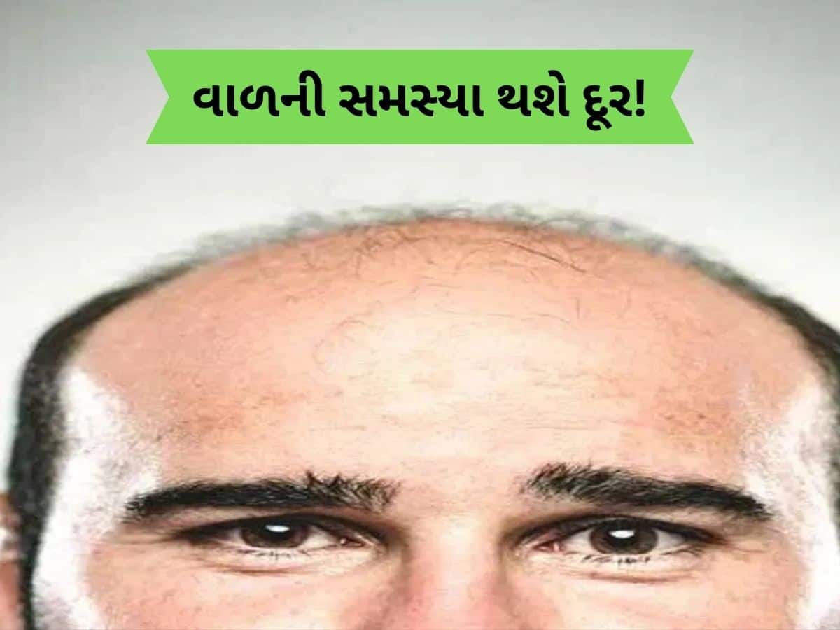 ટાલ પડી ગઈ હશે તો માથામાં ઉગવા લાગશે નવા વાળ, બસ અપનાવો આ દેશી પ્રયોગ