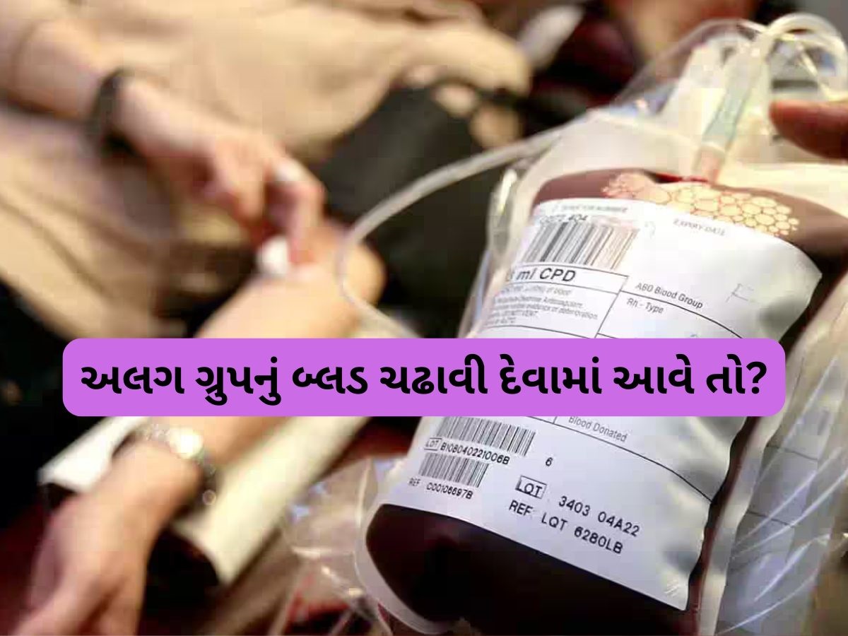 ખોટા બ્લડ ગ્રુપનું લોહી ચઢાવવાથી શું વ્યક્તિનું તત્કાલ થઈ જાય છે મોત, જાણો શરીર પર શું થાય છે અસર? ખોટા બ્લડ ગ્રુપનું લોહી ચઢાવવાથી શું વ્યક્તિનું તત્કાલ થઈ જાય છે મોત, જાણો શરીર પર શું થાય છે અસર?