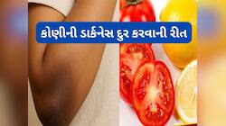 મોંઘી ક્રીમ કે બ્લીચની જરૂર નહીં પડે, આ વસ્તુ લગાડવાથી 3 દિવસમાં સાફ થવા લાગશે કોણી 