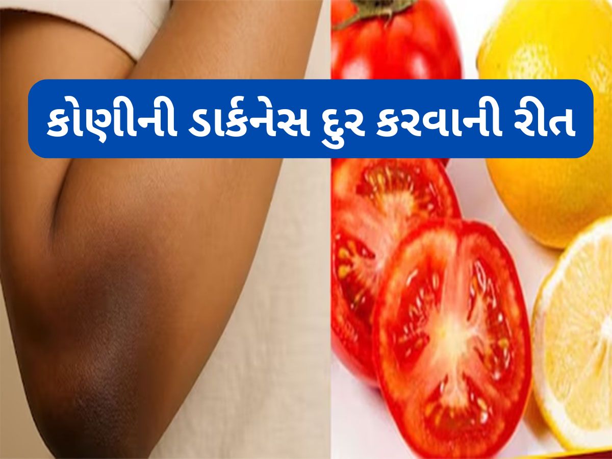 Beauty Tips: મોંઘી ક્રીમ કે બ્લીચની જરૂર નહીં પડે, આ વસ્તુ લગાડવાથી 3 દિવસમાં સાફ થવા લાગશે કોણી અને ઘુંટણ Beauty Tips: મોંઘી ક્રીમ કે બ્લીચની જરૂર નહીં પડે, આ વસ્તુ લગાડવાથી 3 દિવસમાં સાફ થવા લાગશે કોણી અને ઘુંટણ