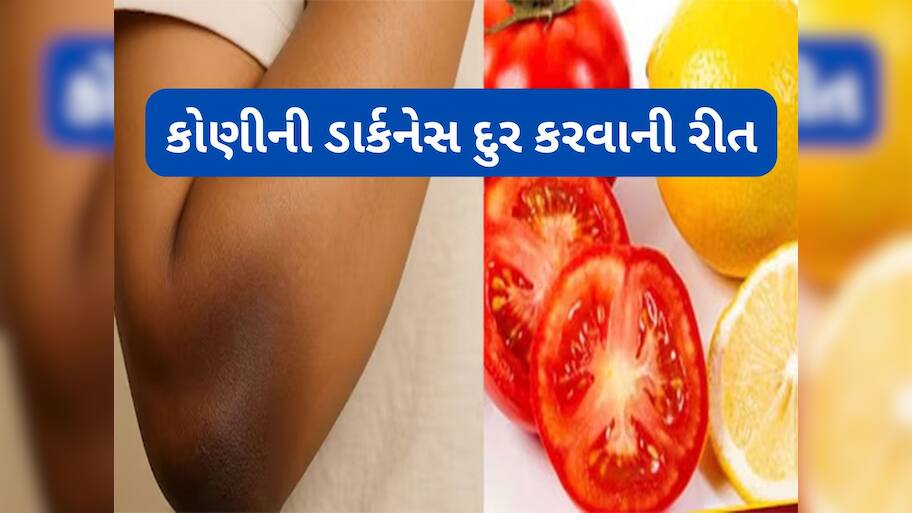 Beauty Tips: મોંઘી ક્રીમ કે બ્લીચની જરૂર નહીં પડે, આ વસ્તુ લગાડવાથી 3 દિવસમાં સાફ થવા લાગશે કોણી અને ઘુંટણ