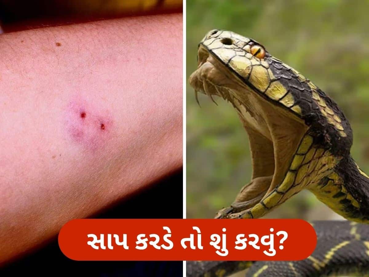 સાપ કરડે તો તાત્કાલિક શું કરવું જોઈએ, આ રીતે તમે શરીરમાં ઝેર ફેલાતું અટકાવી શકો છો