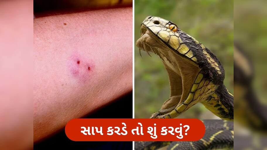 What should be done after a snake bite | સાપ કરડે તો તાત્કાલિક શું ...