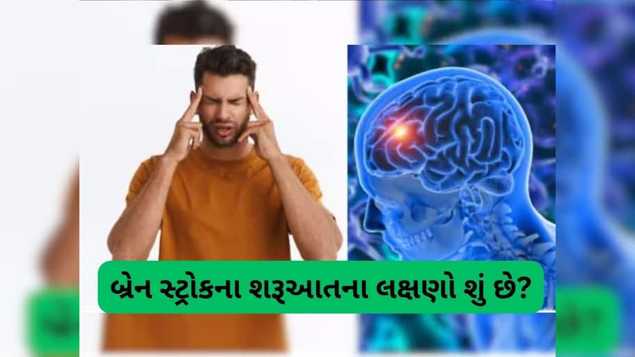  બ્રેન સ્ટ્રોક થાય તો સૌથી પહેલા જોવા મળે છે આ 3 લક્ષણ, ઓળખી લેશો તો બચી જશે જીવ