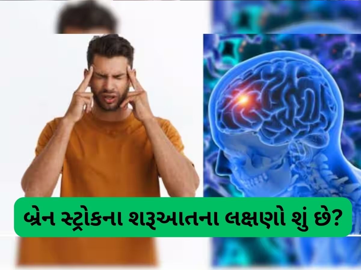 બ્રેન સ્ટ્રોક થાય તો સૌથી પહેલા જોવા મળે છે આ 3 લક્ષણ, ઓળખી લેશો તો બચી જશે જીવ બ્રેન સ્ટ્રોક થાય તો સૌથી પહેલા જોવા મળે છે આ 3 લક્ષણ, ઓળખી લેશો તો બચી જશે જીવ