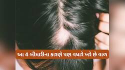 શેમ્પૂ કે પાણીના કારણે જ નહીં, શરીરમાં આ 4 બીમારી વધતી હોય તો પણ ખરવા લાગે છે વાળ