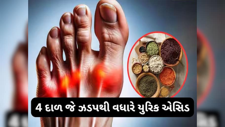 Uric Acid: આ 4 દાળ અને કઠોળ ઝડપથી વધારી શકે છે યુરિક એસિડ, જામ થઈ જશે શરીરના સાંધા