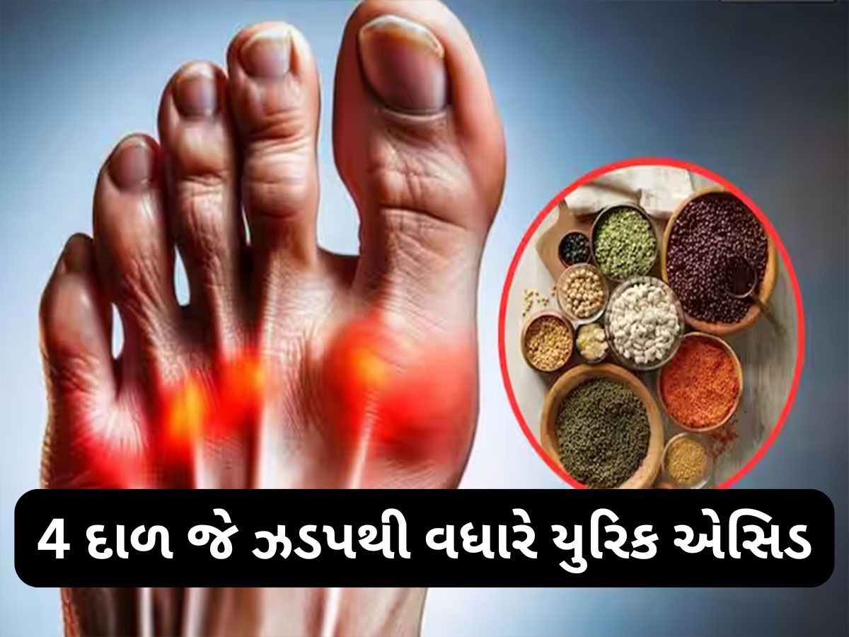 Uric Acid: આ 4 દાળ અને કઠોળ ઝડપથી વધારી શકે છે યુરિક એસિડ, જામ થઈ જશે શરીરના સાંધા Uric Acid: આ 4 દાળ અને કઠોળ ઝડપથી વધારી શકે છે યુરિક એસિડ, જામ થઈ જશે શરીરના સાંધા