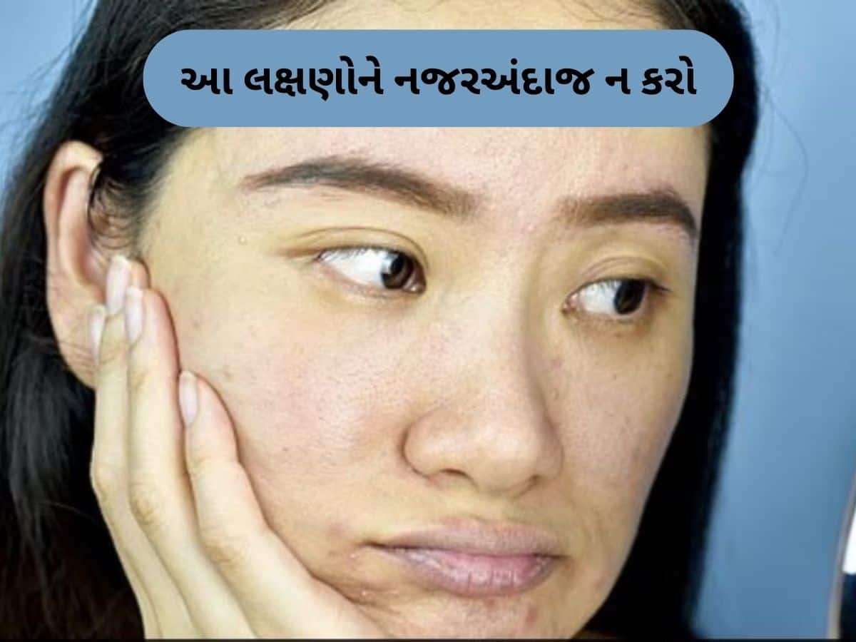  જો ચહેરા પર આ 6 નિશાન દેખાય, તો સમજો કિડની ફેલ થવાની છે, તાત્કાલિક હોસ્પિટલમાં જાઓ