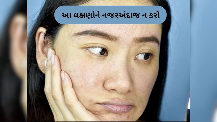  જો ચહેરા પર આ 6 નિશાન દેખાય, તો સમજો કિડની ફેલ થવાની છે, તાત્કાલિક હોસ્પિટલમાં જાઓ