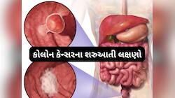 સવારે બાથરુમમાં દેખાય છે આંતરડાના કેન્સરની શરુઆતનું લક્ષણ, ઈગ્નોર કરશો તો હેરાન થશો