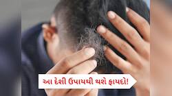 માત્ર 15 દિવસમાં બંધ થઈ જશે ખરતાં વાળ, કમાલનો છે આ હોમિયોપેથિક નુસ્ખો