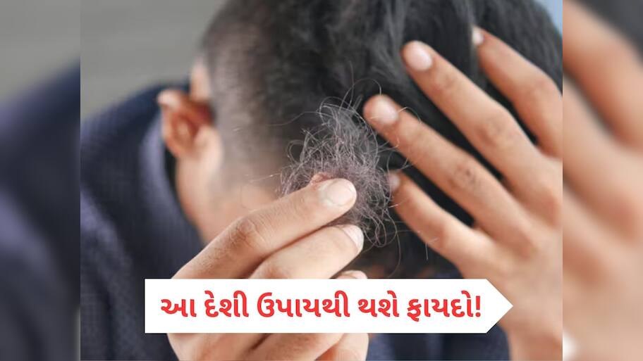 માત્ર 15 દિવસમાં બંધ થઈ જશે ખરતાં વાળ, કમાલનો છે આ હોમિયોપેથિક નુસ્ખો