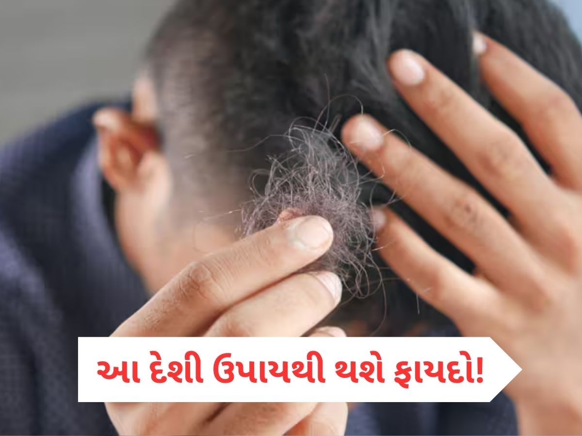 માત્ર 15 દિવસમાં બંધ થઈ જશે ખરતાં વાળ, કમાલનો છે આ હોમિયોપેથિક નુસ્ખો માત્ર 15 દિવસમાં બંધ થઈ જશે ખરતાં વાળ, કમાલનો છે આ હોમિયોપેથિક નુસ્ખો